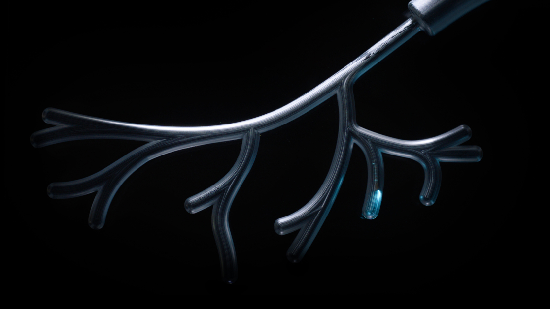 Lung nodules represented by a 3D graphic